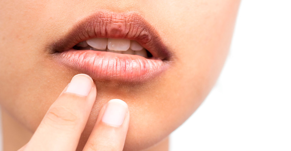 4 أسباب وراء رائحة الفم الكريهة وطرائق الخلاص منها
