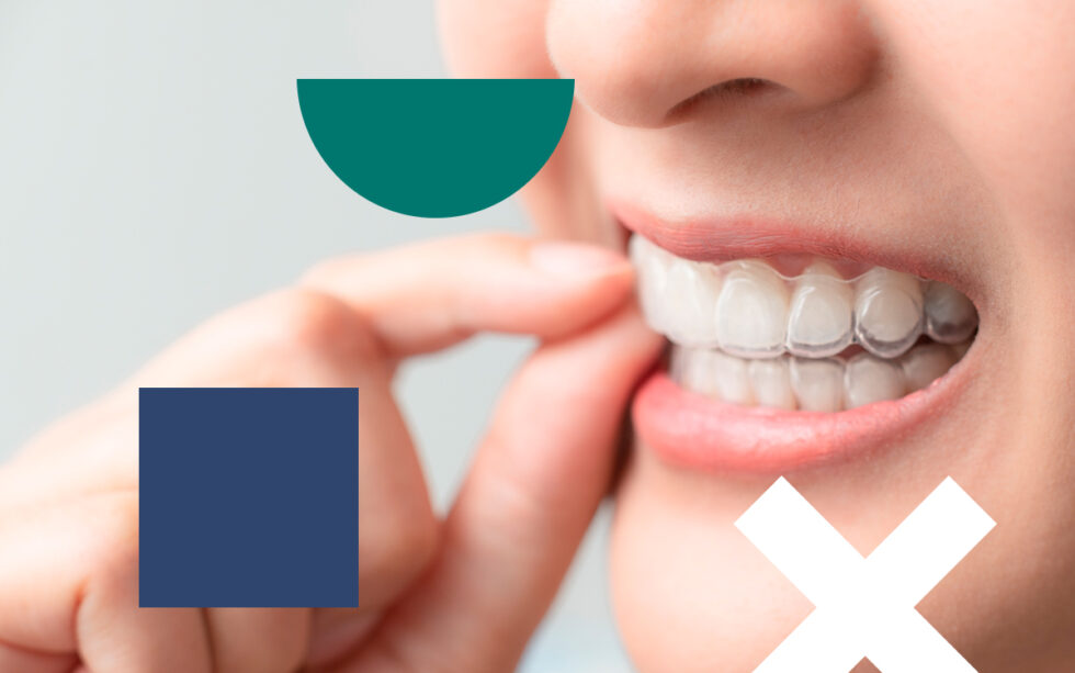 10 Things You Should Know About How Invisible Aligners Work