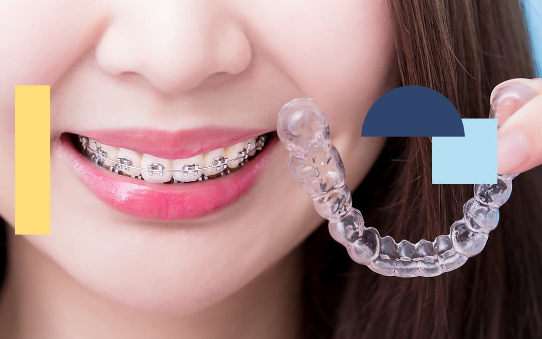 treating pain from braces