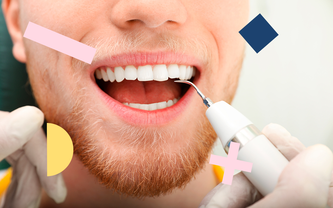 Comment enlever le tartre des dents ? - Laboratorios KIN