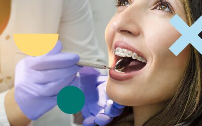 Ortodoncia en adultos ¿Es conveniente?
